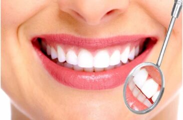 Quy trình bọc răng sứ: Phục hình sứ đẹp tự nhiên cho nụ cười hoàn hảo